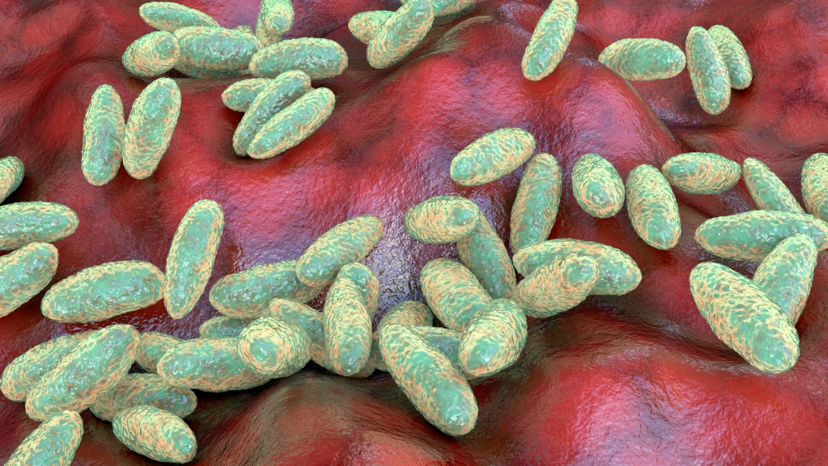 US monitors suspected fatal pneumonic plague case in Russia